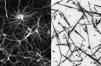 Illustration article « Des nanoréseaux artificiels dotés des mêmes capacités d’apprentissage qu’un cerveau humain » sur Trust My Science